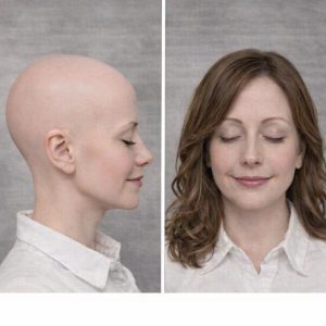Protesi capelli donna modello Piemonte