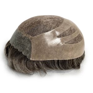 Infoltimento non chirurgico modello Strong (capelli europei)