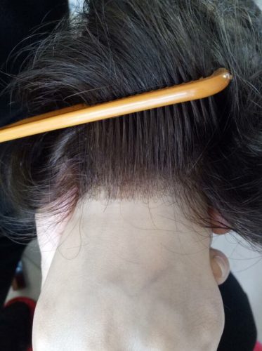Ci sono tanti miti da sfatare sulle patch cutanee