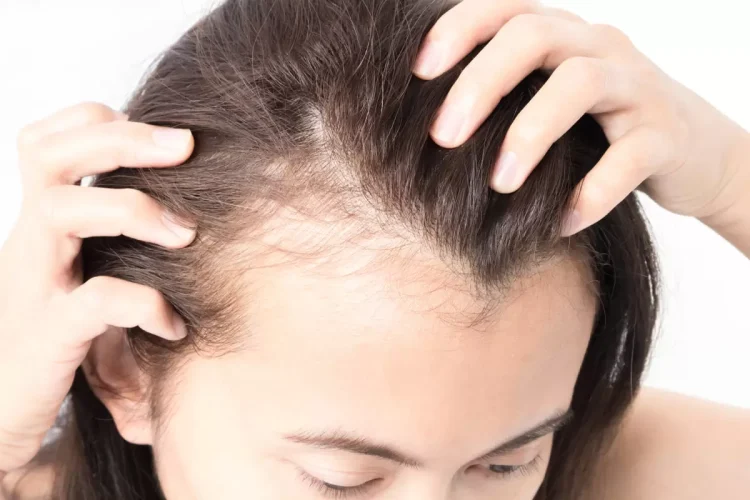 Diradamento-capelli-donna