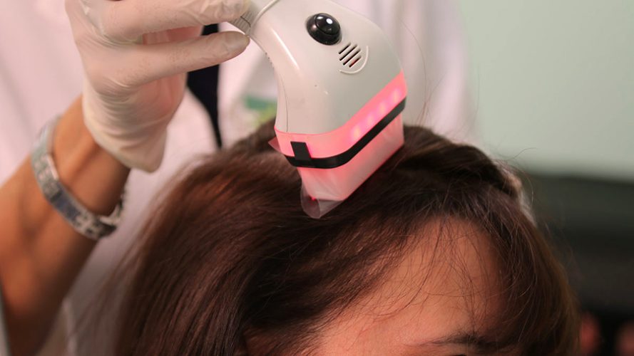 laser-capelli