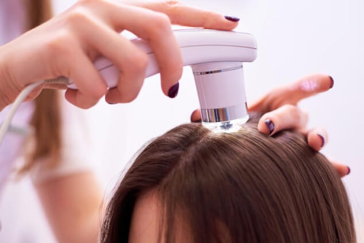 Come il tricologo può aiutarti con la caduta capelli